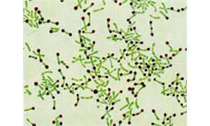 ALBERT STAIN B SOLUTION