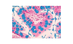 ALCIAN BLUE SOLUTION
