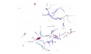 CARBOL FUCHSIN STRONG STAINING SOLUTION