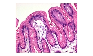 HEMATOXYLIN SOLUTION MODIFIED ACC.TO GILL II