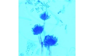 LACTOPHENOL (COTTON BLUE)