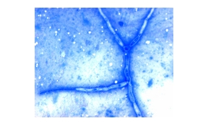 METHYLENE BLUE SOLUTION