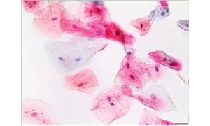 PAPANICOLAOUS SOLUTION EA36