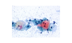 PAPANICOLAOUS SOLUTION EA65